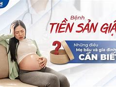 Tiền Sản Vật Là Gì